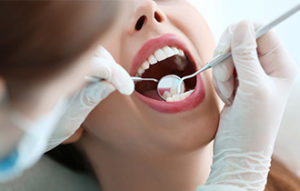 歯科衛生士による歯のクリーニング
